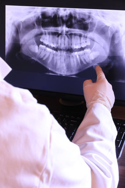Best Emergency Root Canal Therapy in Union City, OH